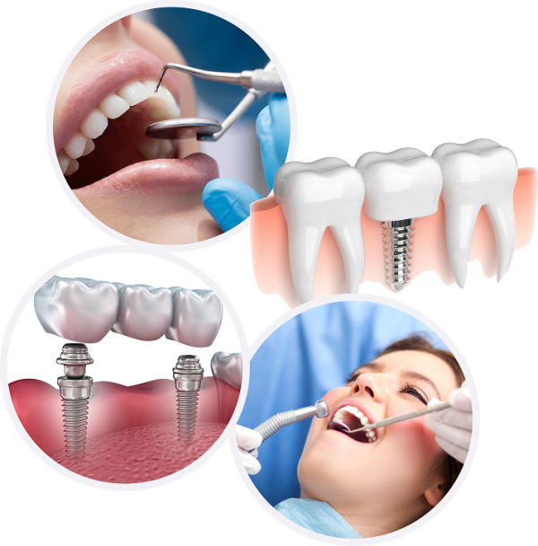Cosmetic dentistry treatment